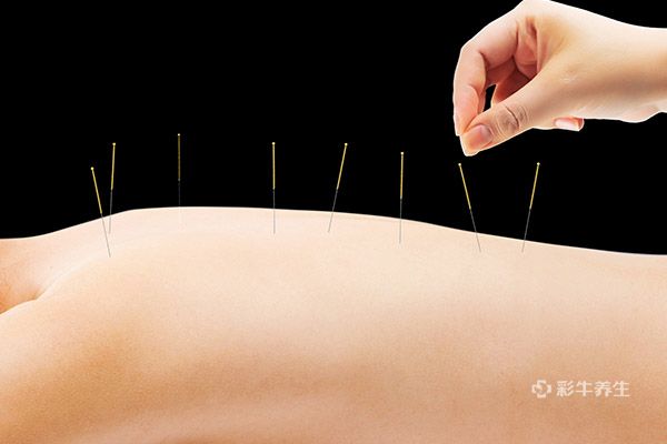 針灸的副作用1.jpg